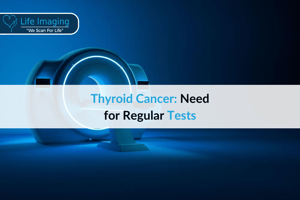 Thyroid Cancer