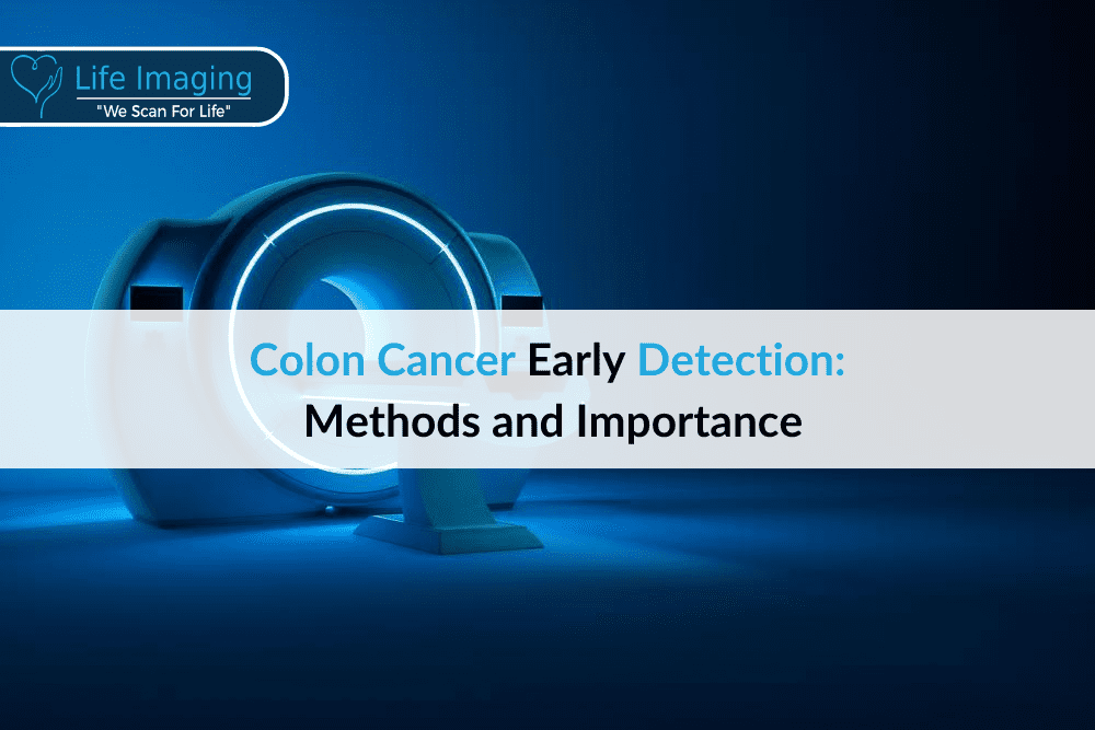 Colon Cancer
