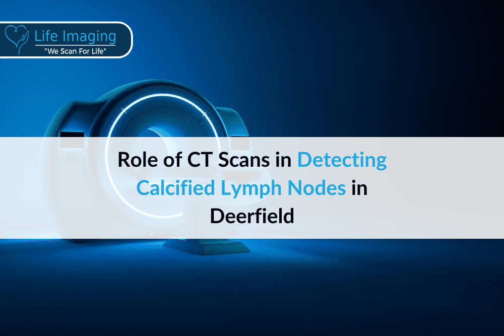 Role of CT Scans in Detecting Calcified Lymph Nodes in Deerfield