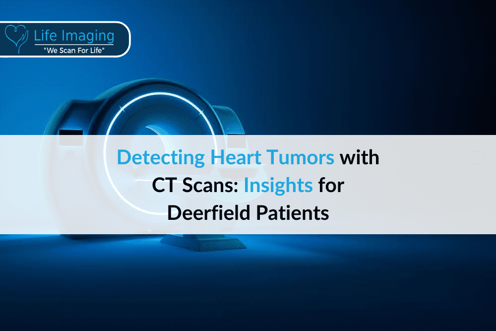 Detecting Heart Tumors with CT Scans: Insights for Deerfield Patients